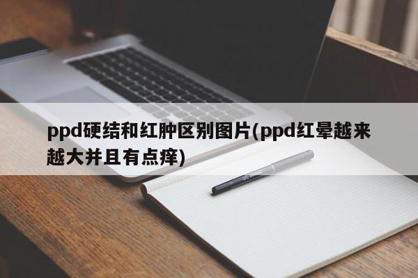 ppd硬结和红肿区别图片(ppd红晕越来越大并且有点痒)